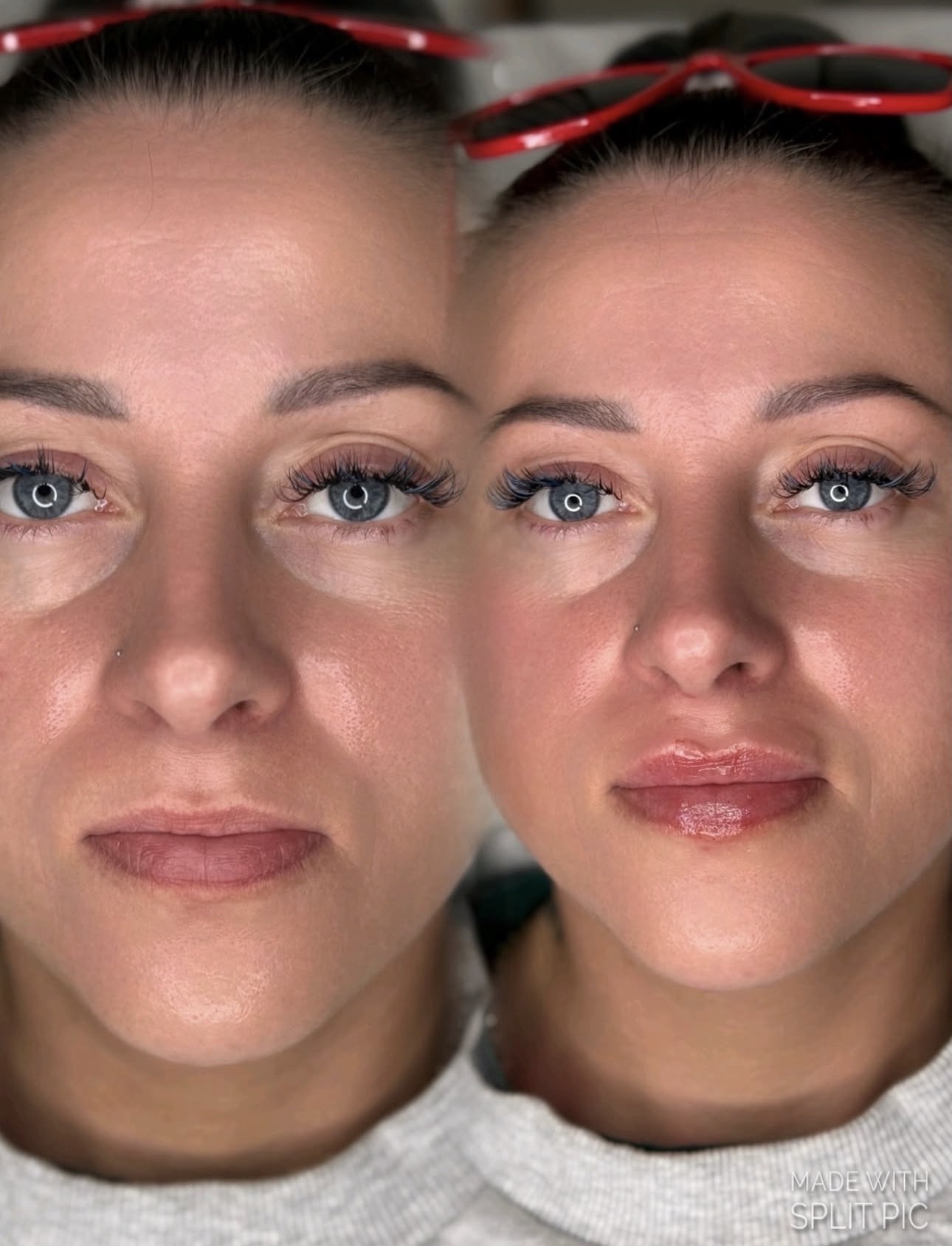 Genuine Dolls Lounge client before and after result 2