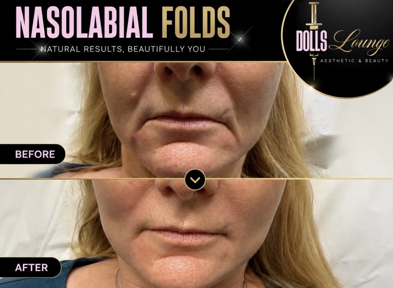 Genuine Dolls Lounge client before and after result 1