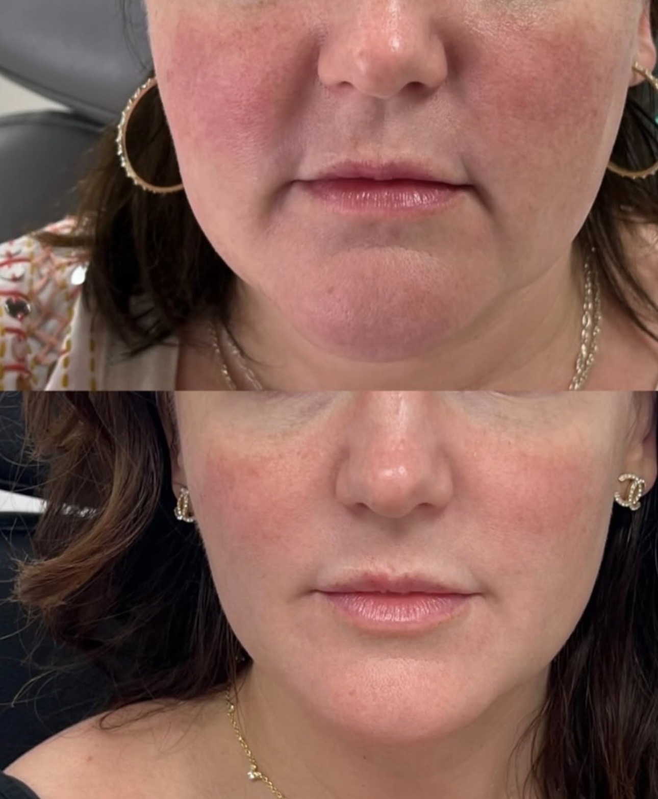 Genuine Dolls Lounge client result